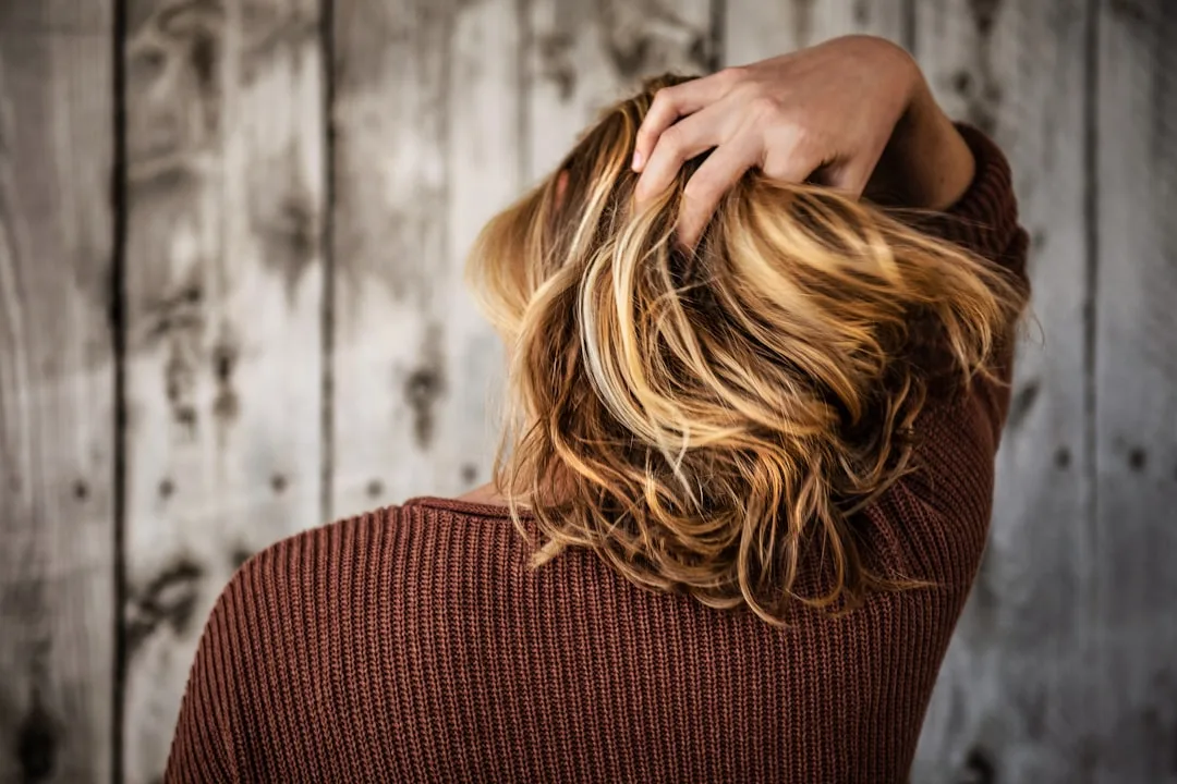 Vitiligo and Alopecia Areata: When Two Autoimmune Conditions Overlap
