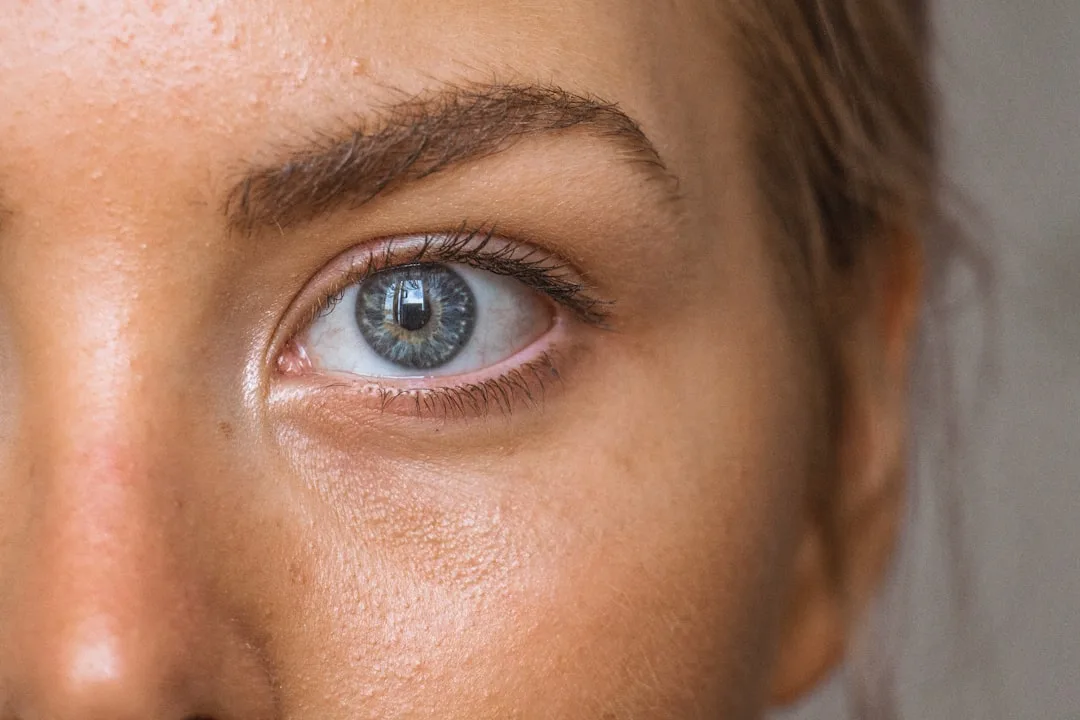 Vitiligo on the Face: Complete Treatment Guide