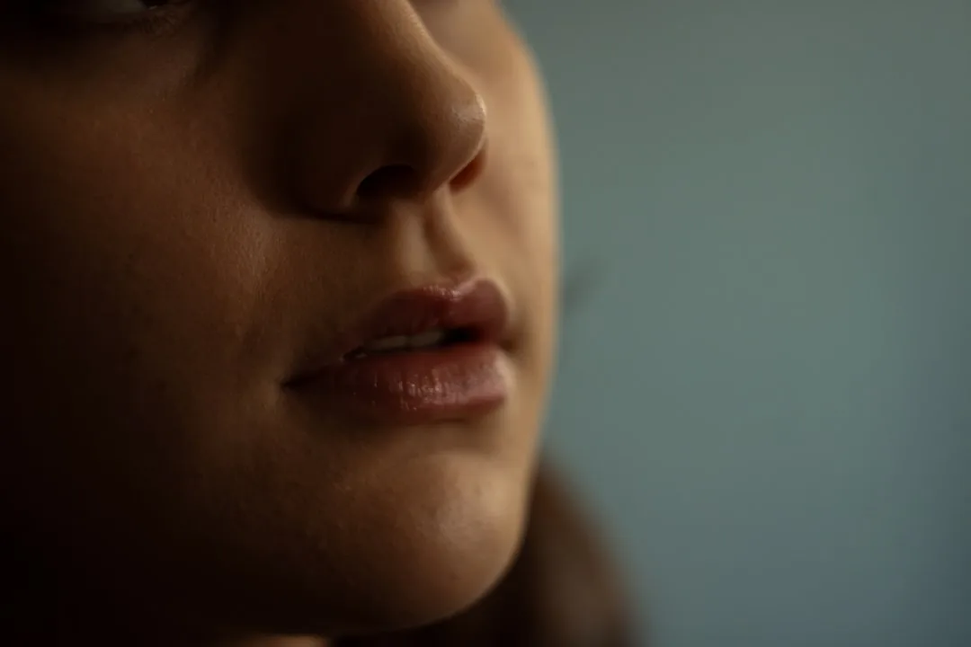 Vitiligo on Lips: Treatment Options and Camouflage