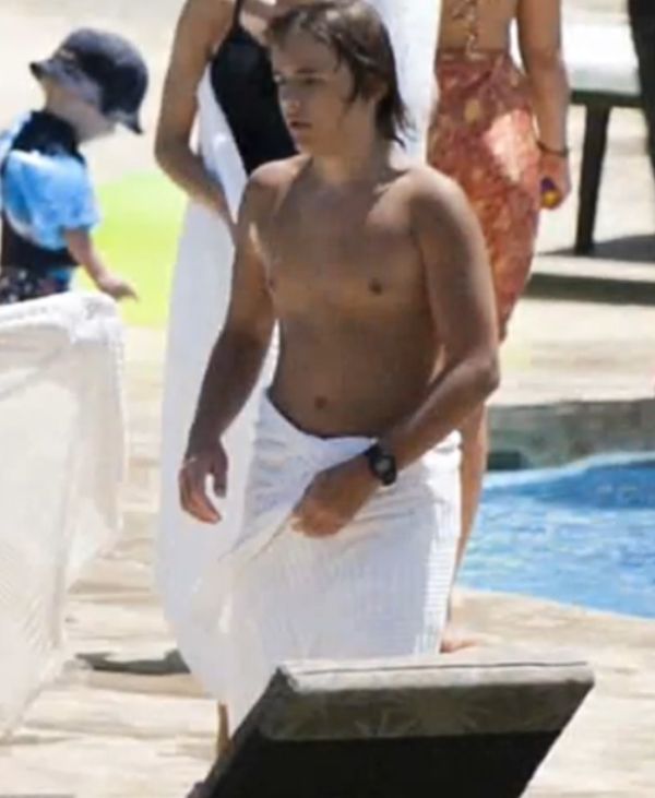 Prince Michael Jackson and Vitiligo: Why Public Speculation Helps No One