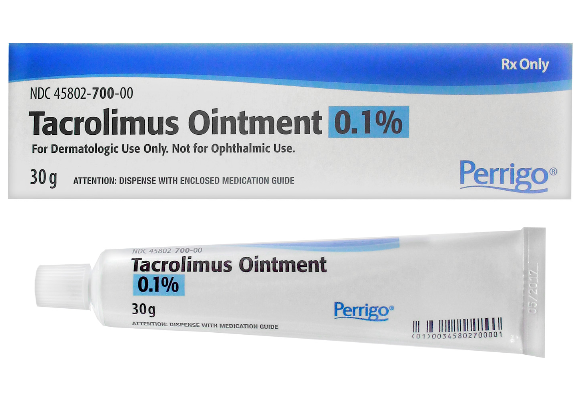 Tacrolimus Ointment for Vitiligo: Where It Fits Best
