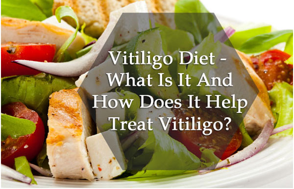 Vitiligo Diet: What to eat and avoid in Vitiligo