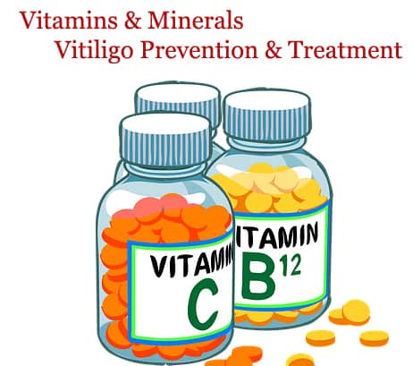 5 Vitamins That Can Help Treat Vitiligo